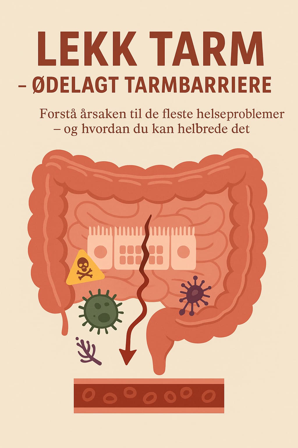 Lekk tarm – ødelagt tarmbarriere – artikkel