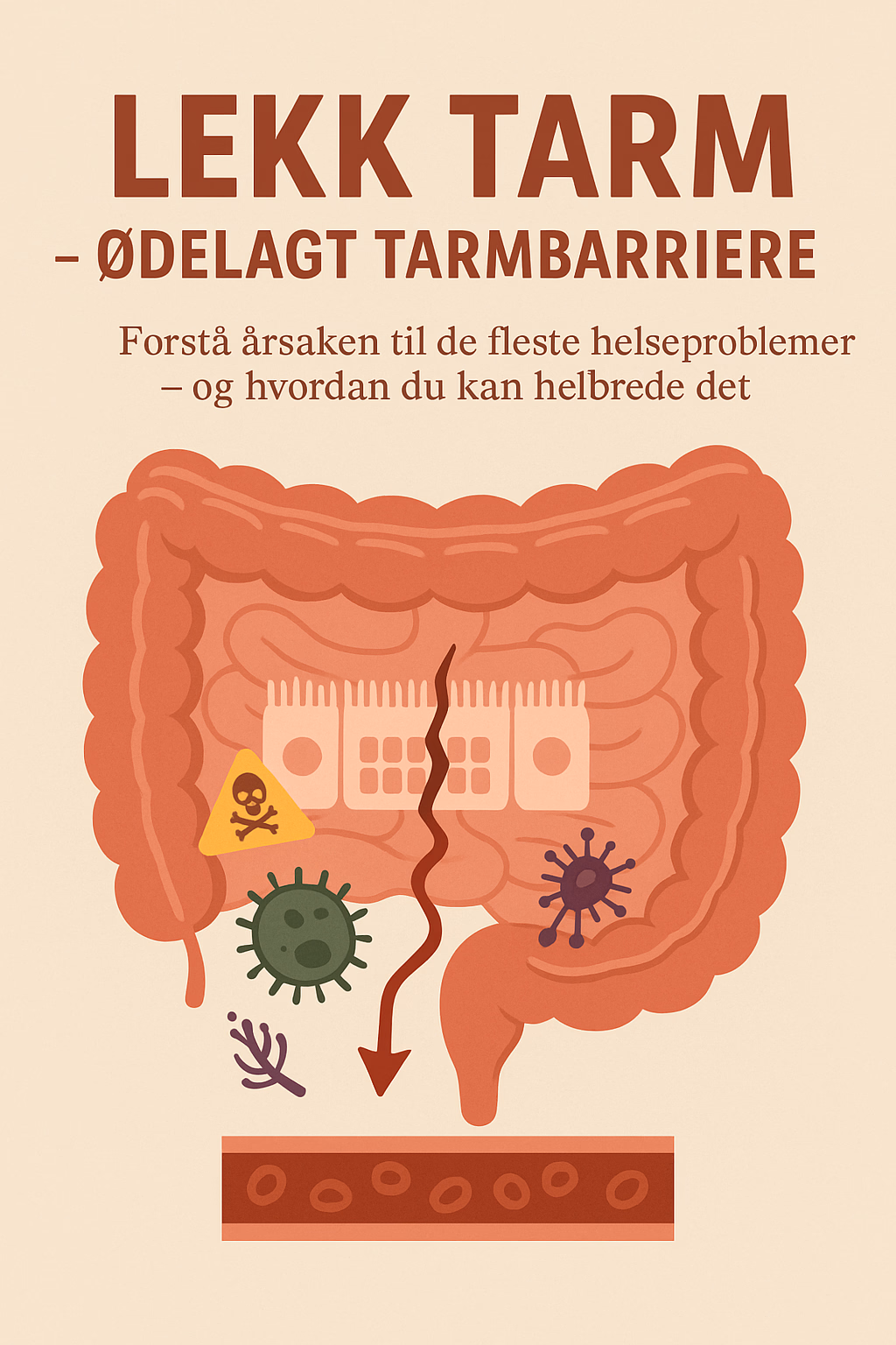 Lekk Tarm – Ødelagt Tarmbarriere